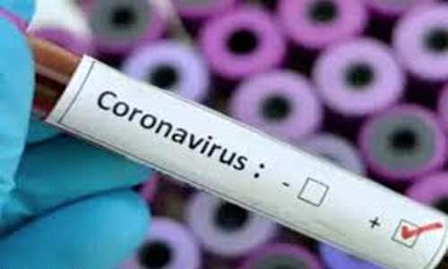 Anglo-French co Novacyt  launches CE-IVD Marked novel coronavirus diagnostics test