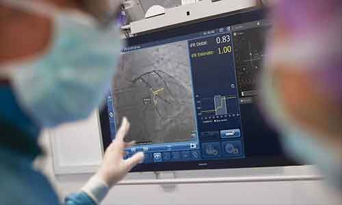Philips announces DEFINE GPS global multicenter study to assess outcomes of PCI procedures guided by integrated iFR and interventional X-ray images