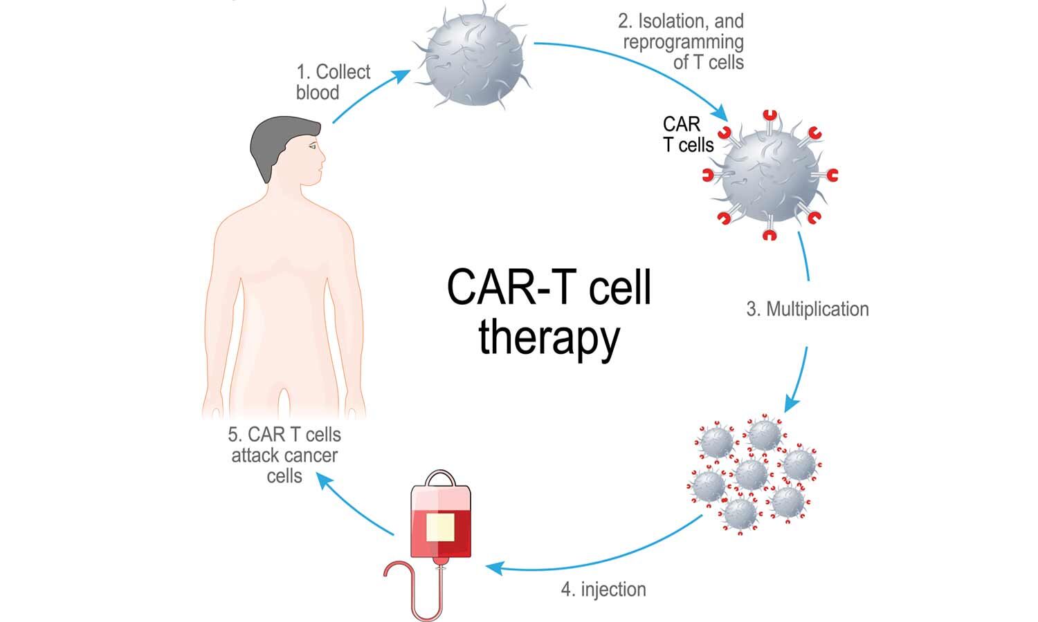 Ministry of Science and Technology invites Concept Proposals for CAR T Cell therapy